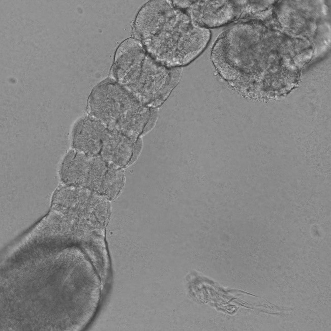 somite organoid in culture