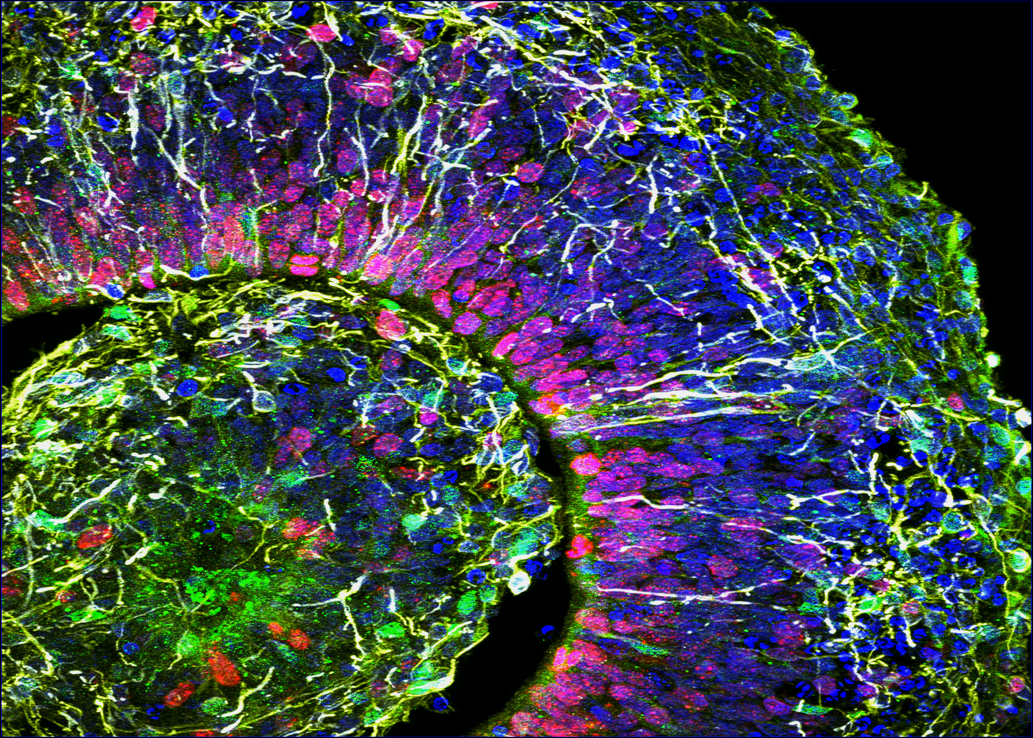 Apples are inspiring new strategies for healing bone by supporting the growth and function of bone cells in a culture dish.